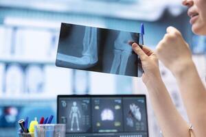 Woman physician reading x ray diagnostics for a patient in medical office, doing a test results scan interpretation to help person with disease. Providing treatment and advice for recovery. photo