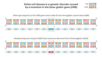 Sickle cell SNP mutation in the beta-globin HBB gene graphic illustration vector