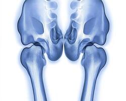 Detailed X-Ray of Human Hip Bones and Femurs photo