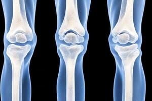 Detailed XRay Images of Human Knees Showing Bone Structure photo