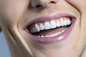 Close-up of a Bright Smile with Healthy White Teeth photo