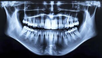 In the realm of oral health, precision is paramount A dentist, armed with cutting-edge diagnostic tools, meticulously conducts a thorough X-ray examination, delving into the intricate details of the photo