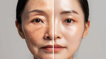 Comparing the effects of aging with younger, youthful skin, Asian woman composite image photo