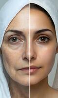 Before and after skincare rejuvenation transformation, anti aging face treatment effect comparison photo