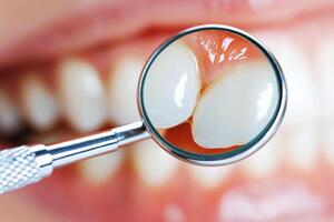 Dentist conducts oral examination with magnifying tool in clinic photo