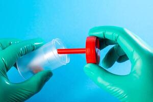 The hands of a doctor laboratory assistant in green medical gloves open a stool analysis for testing for calprotectin and worms, close-up. Copy space for text photo
