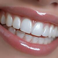 Extreme Close-Up of Glossy Enamel Texture and Perfect White Teeth photo
