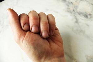 Left male hand with cuts and dirt close-up Right male hand photo