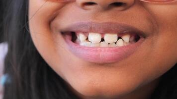 Smiling child showcases missing front teeth during summer fun video