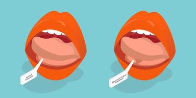 3D Isometric Flat Conceptual Illustration of Ankyloglossia, Short Lingual Frenum That Interferes with Normal Tongue Movement. vector