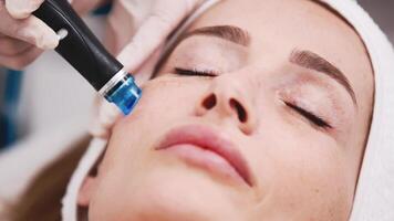 Close-up of a woman undergoing a hydropeeling facial treatment in a cosmetology clinic. Concept of deep cleansing and skin rejuvenation using advanced technologies video