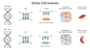 Sickle Cell Anemia HBB point mutation graphic vector
