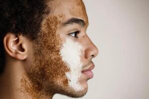 Young Man Profile Showing Skin Condition And Face Mask photo