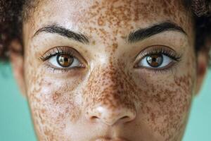 A woman with freckles on her face photo