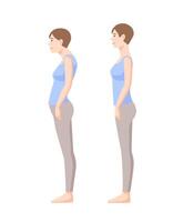 Young smiling woman standing in good and bad postures isolated on white background. Neutral spine, correct and incorrect poses. Side view. Colorful illustration in flat cartoon style vector