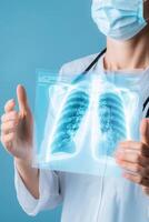 Close-up analysis of chest X-rays showing distinct signs of sarcoidosis for healthcare professionals photo