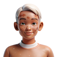 beautiful contemporary Portrait of a person with vitiligo, showcasing their unique skin patterns, lit by soft, diffused light, in a naturalistic, photographic style genuine png