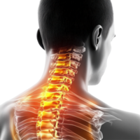 Neck pain illustration showing cervical spine and surrounding muscles on a Transparent background, Neck Pain, background png