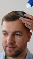 Man with dandruff undergoing scalp examination at trichologist video