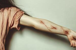 Person with scratched arm showing deep marks against a neutral background in a dimly lit setting photo