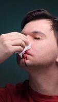vertical Man is holding tissue to bleeding nose and suffering from nosebleed video