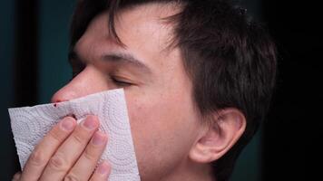 Man wiping blood from nosebleed with tissue paper video
