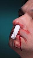 vertical Man suffering from nosebleed holding tissue against nostrils. stopped with a tampon video
