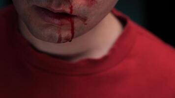 Man suffering from nose bleeding wearing red sweatshirt video
