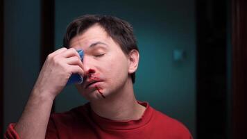 Man using ice pack for nosebleed and bruising injury video