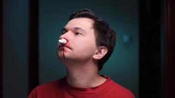 Man suffering from nosebleed holding tissue against nostril video