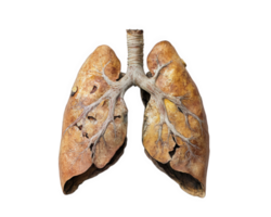 Isolated human lungs with detailed bronchi and texture, showcasing anatomical features and structure. Ideal for educational and medical purposes png