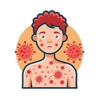 Severe Skin Rash and Irritation Caused by Bacteria vector