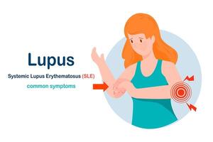 Common symptoms of lupus or SLE vector
