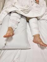 A patient lying on a bed with both legs wrapped in a blood circulation device, used after knee replacement surgery in the hospital. photo