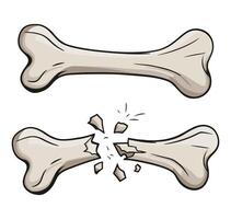 Set of human bone skeleton elements. Includes crossed bones, for Jolly Roger or pirate flag. vector