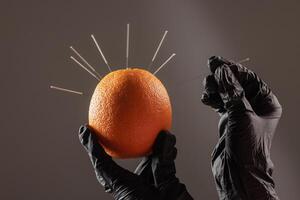 concept dry needling method. Acupuncture training concept. Black-gloved hands insert fine needles into an orange to practice needling techniques in alternative medicine. photo