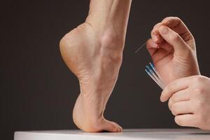 concept dry needling method, Acupuncture therapy on the foot, close-up of a practitioner's hands inserting thin needles into the heel for pain relief and alternative medicine. photo