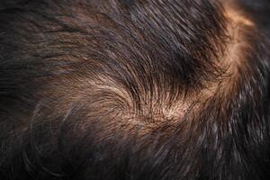 Close-up of scalp with unique hair swirl pattern photo