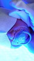 UV light phototherapy for a newborn child. Treatment of childhood jaundice in maternity hospital. Close up. Vertical video