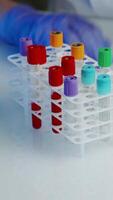 Test tubes with blood samples. Lab technician assistant analyzing a blood sample in test tube at laboratory video