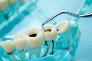 Teeth dental model with tool for dentist use to cleaning care trea photo