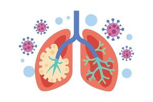 Lungs with Virus Flat Design, Pulmonary System with Infection on White Background vector