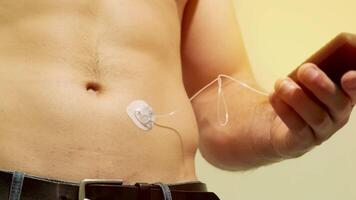 Diabetic man with an insulin pump connected in his abdomen and holding the insulin pump at his hands. Diabetes concept. 14 video