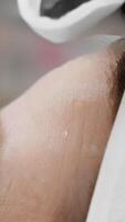 This image shows an experienced practitioner skillfully administering botulinum injections to reduce wrinkles, highlighting the professionalism and precision involved in cosmetic treatments video