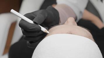 An expert practitioner marks the treatment area on the clients forehead, preparing for a precise botulinum injection to effectively reduce wrinkle appearance during a cosmetic procedure video