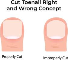 Proper and Improper Toenail Cutting Techniques Illustration vector