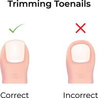 Proper Toenail Trimming Guide Correct vs Incorrect Illustration vector