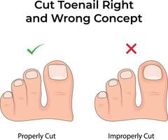 Proper vs Improper Toenail Cutting A Guide to Healthy Feet Illustration vector