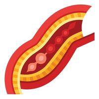Artery Layers Section Flat Design with Red Blood Clot on a White Background vector
