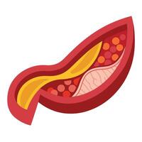 Artery Cross Section with Layers, Blood Cells, and Plaque on White vector